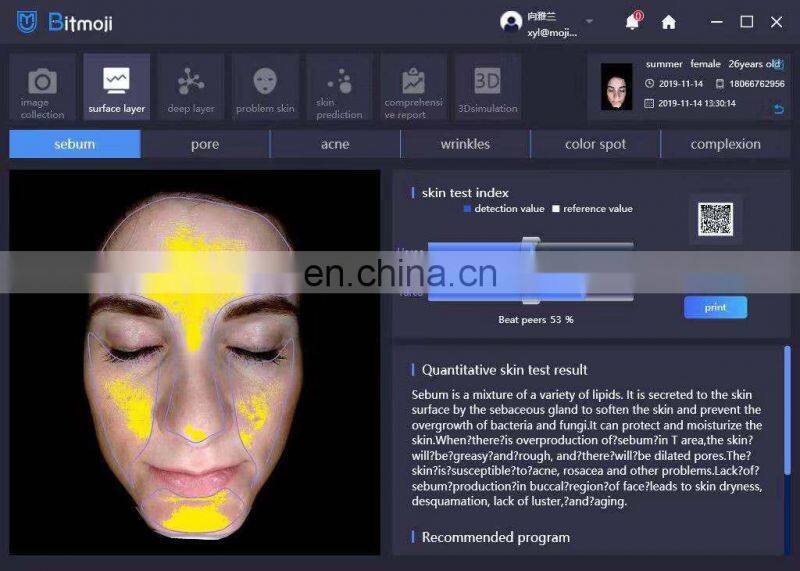 Trending 2021 smart skin analyzer skin analyzer facial skin type analyzers