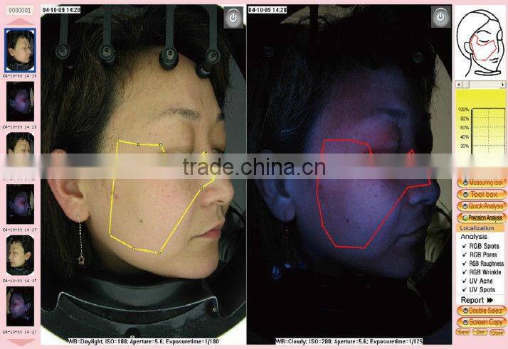 portable skin analyze machine/uv skin analyzer/skin analyzer