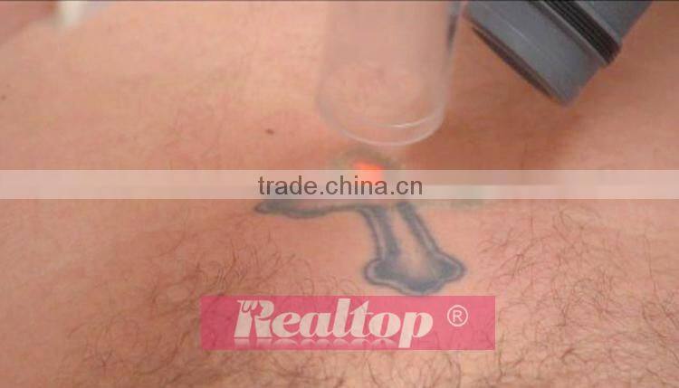Inventions and innovations 2016 1064 nm 532nm q switch nd yag laser washing tatto machine removing ink tattoo machine kit