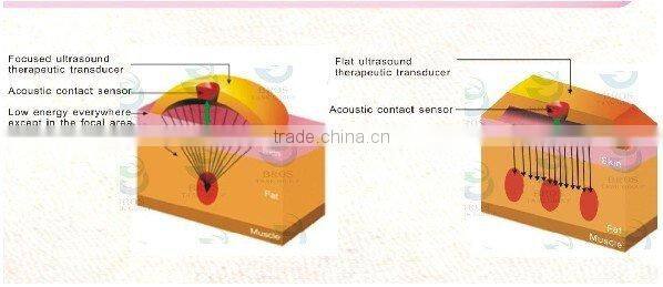 RF Skin Rejuvenation Vacuum Cavitation System