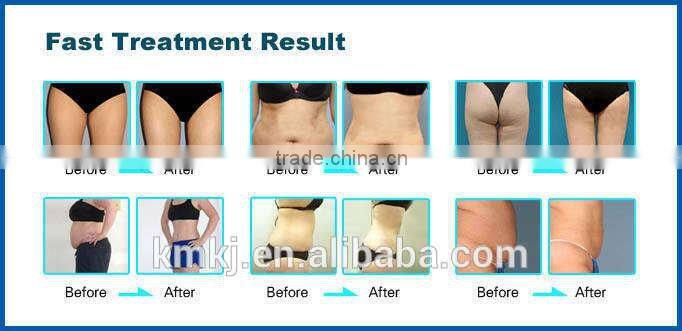 Distributor 7 in 1 cavitation vacuum rf slimming machine