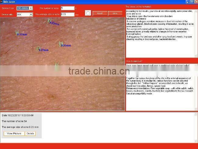 2015 Latest 3D Skin Analyzer/ Skin Analyser(English version software)