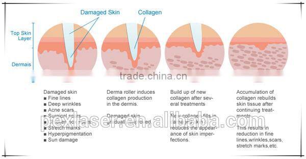 2016 derma rolling system micro needles skin care roller with 1200 needles