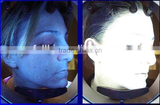 skin analyzer software /skin and hair testing machine /face skin test machine