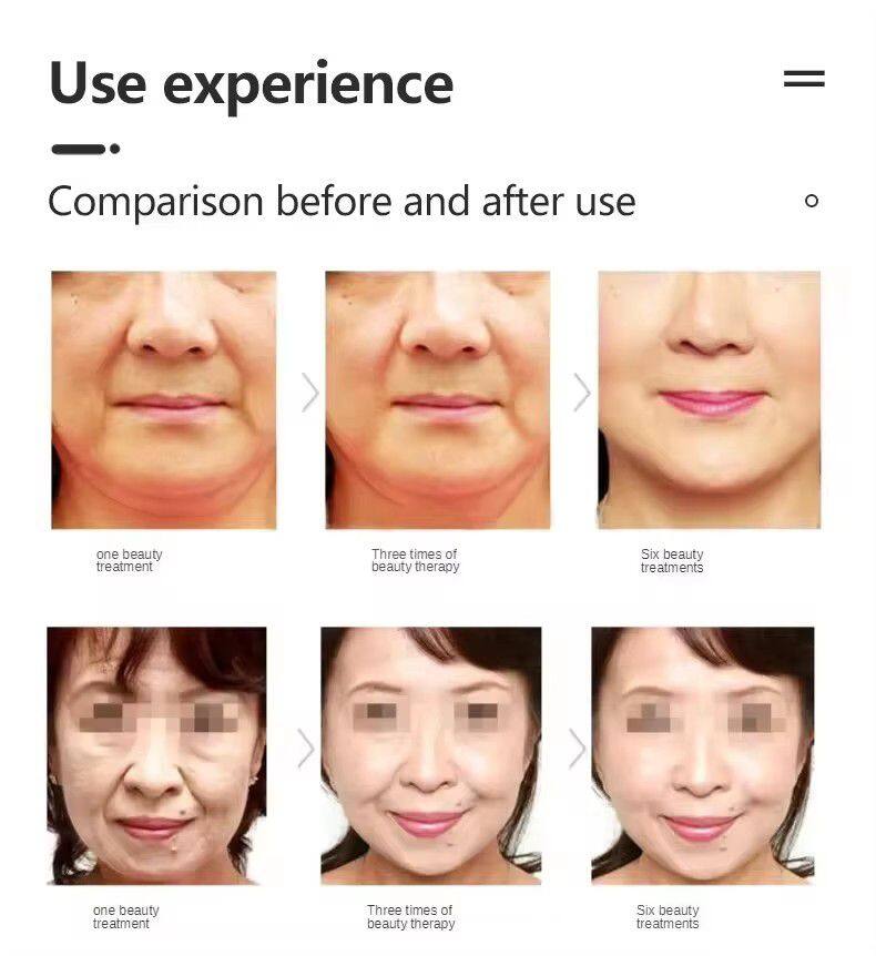 Desktop No-cartridges Vmax 3D Face Lifting V Line Carving Wrinkle Removal Skin Tightening Ice Sculpture Beauty Machine