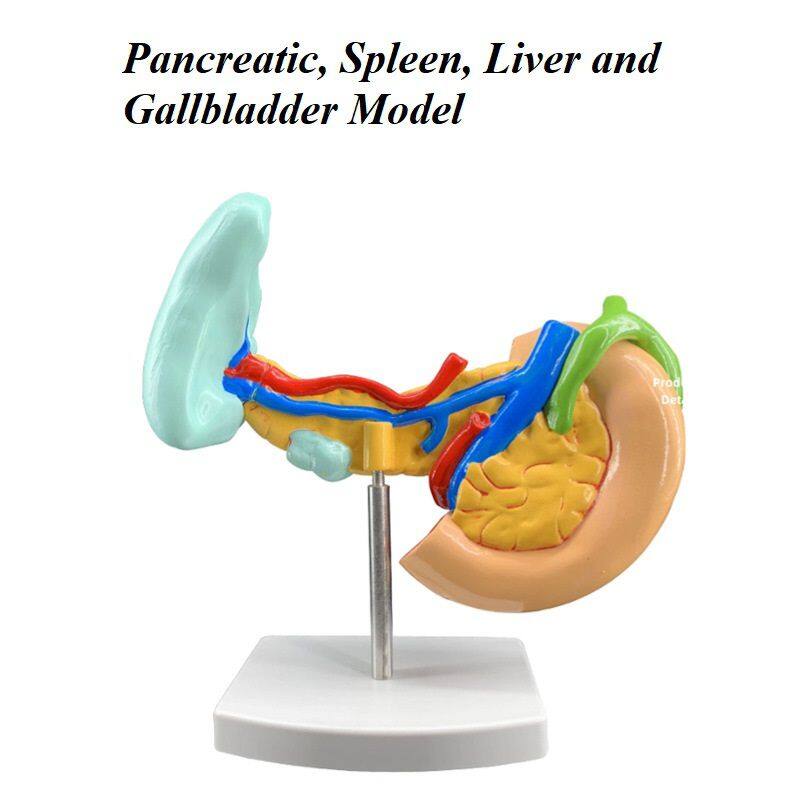 病变胰脾模型 85元.jpg