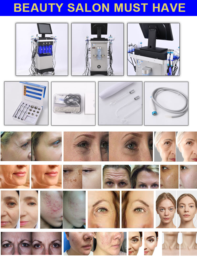 Hydra Diamond Peeling Oxygen Spray Machine for Skin Care Microdermabrasion Water Het Cleaning Oxygen Facial Machine