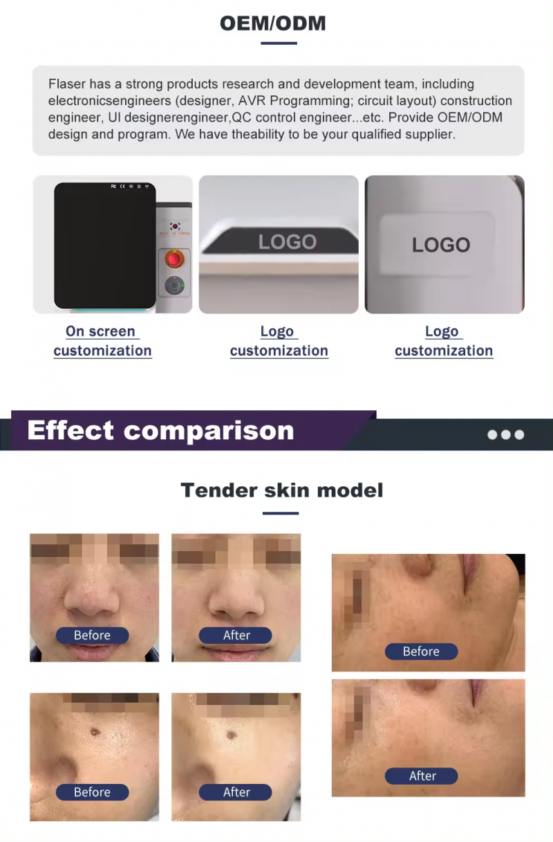 Japan DPL IPL Portable Beauty Machine for Hair Removal Skin Rejuvenation Door to Door Service