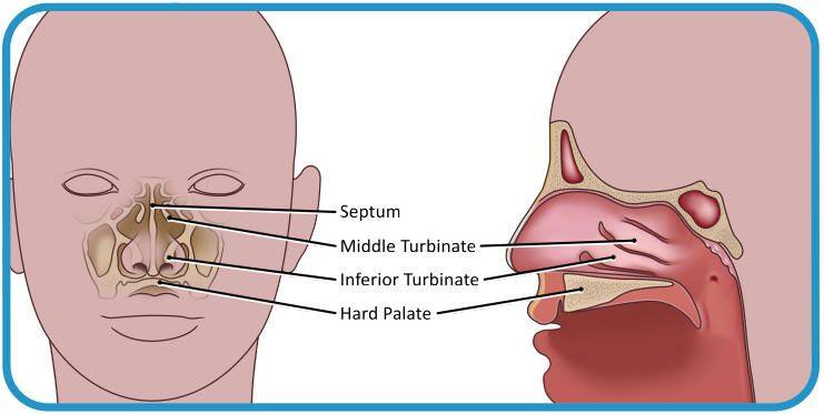 Nasal Mid-Turbinate Specimen Collection: Step-by-Step Guide