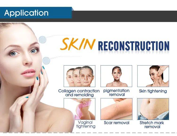 ADM Top Quality CE Approved Vaginal Tightening Fractional Co2 Laser Acne Scar Removal Skin Resurfacing CO2 Laser Machine