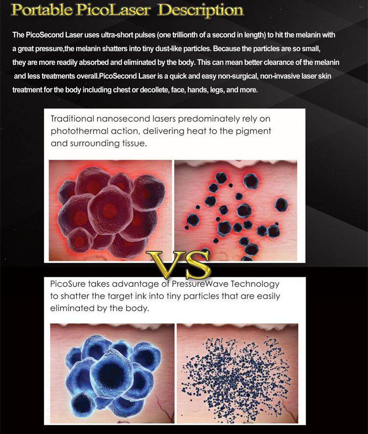 Non-Invasive Portable NDyag Pico Laser Beauty Machine Q-Switched Nd Yag Laser Pico Black Dot Skin Whitening Beauty Equipment