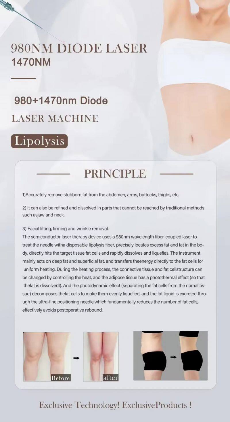 2024 Hot Selling Portable Fat Reduce 1470nm 980nm Diode Laser Multi-functions for Spider Vein Removal