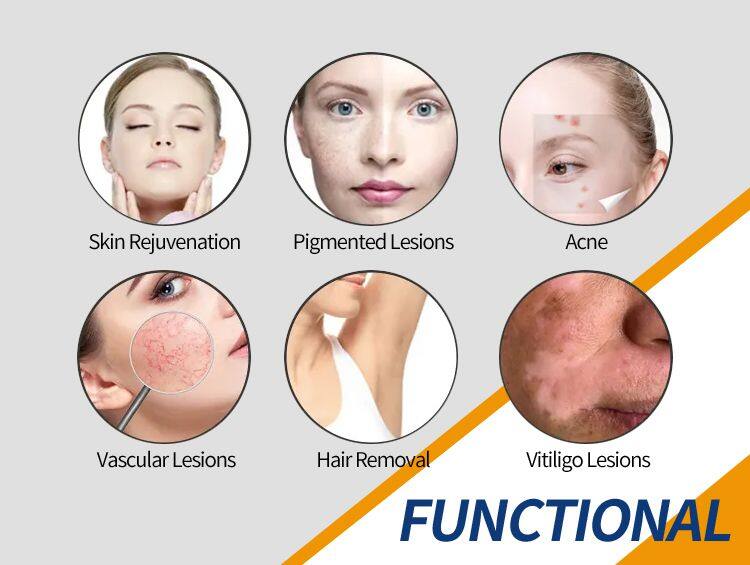 Portable DPL Optical Skin Beautification Skin Rejuvenation BBL Pigmentation 480nm Dpl Freckles Age Spots Removal