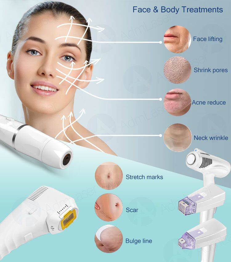 Micro Needle RF Face Lifting and Fat Reduce for Face Body Slimming ICE Beauty Equipment