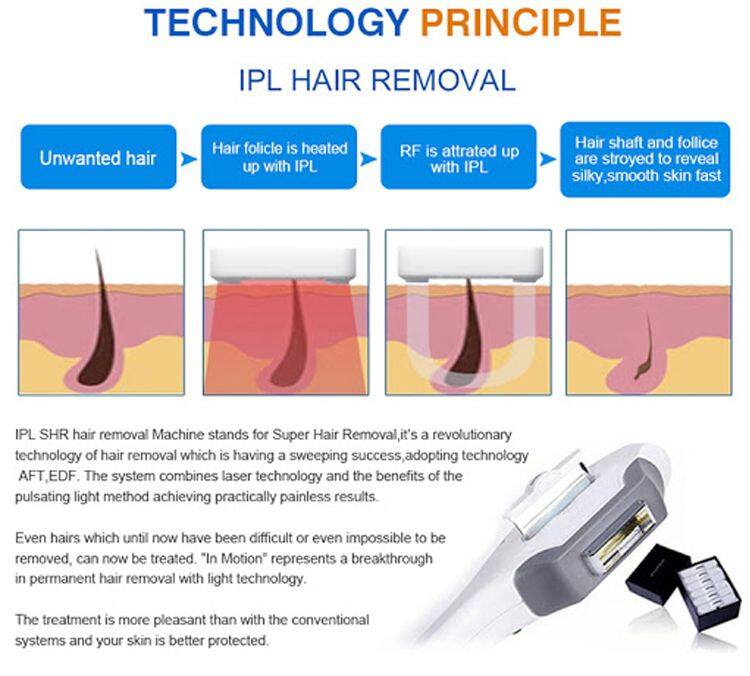 CE Approved IPL Laser Elight Ipl for Hair Removal and Whiten Skin E-light OPT Hair Removal Beauty Machine