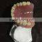 Integrated Denture Model Teaching Demonstration
