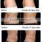 2017 CE Approval Vacuum Fat Freezing Advanced Cryo for Slimming, Cryo Slimming Machine CoolPlas