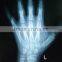 Konida medical film replace Agfa DT2B and Fuji DI-HT
