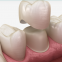 Temporary Teeth Lab from China