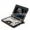 MY-A039B Portable Cardiac Ultrasound System Color Doppler Ultrasound Machine Scanner Price with Ultrasound Probe