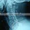 Konida Xray medical dry film compatible with Agfa Drystar and Fuji Drypix