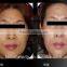 2016 diamonds miceodermabrasion tips/diamonds microdermabrasion oxygen/ diamod peeling machine