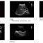 MC-ivis20 4D Black and White Ultrasound Machine