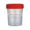 Widely Used Medical Plastic Urine Collection Container