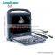 Sonoscape Portable Digital ultrasound machine color doppler