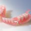 China Full Acrylic Denture Flipper Complete Denture Dental Supply Dental Crown Dental Unit Denture Orthodontic Products Dental Products