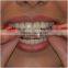 dental impression tray kit/ silicone material custom fit teeth whitening tray