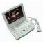 Laptop Ultrasound Scanner-RSD-RP6A(HUMAN)