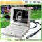 MSLVU08 2015 hottest type portable laptop vet equine ultrasound equipment