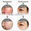 755+1064 Alexandrite laser permanent hair removal machine pigmentation correctors
