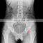 HC-D017 CCD Based Uc-Arm Digital X-ray Machine /X Ray Equipment/Digital Machine