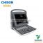 medical User-friendly 2d portable black and white ultrasound CHISON ECO2