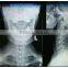 2015 new hot blue film blue film without cloths Medical x-ray blue film thermal dry film for hospital