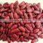2015 Dark Red Kidney Bean