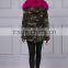 Hot Pink Thick Part Fox Fur Trimmed Luxury Ladies Fashion Short Parka