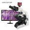 ZHONGXUN ZX71M(200HD) Hot High Quality Trinocular Drawtube Biological Microscope Theory with HDMI Camera 40X-1000X