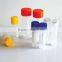 medical lab consumables cryogenic vials sterilized