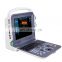CE Approved Portable Ultrasound Scanner Color Doppler Medical Ultrasound Instruments for hospital
