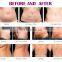 Portable low price multifunctional dual handle fat freezing slimming machine with vacuum cavitation system