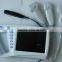 ATNL/51353C Full Digital Palm Ultrasound Scanner