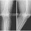 medical dry film agfa mqct-178/14x17in blue dry x ray film with high quality and cheap price/blue x ray medical film