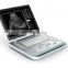 15 inch 2D/3D B/W Laptop digital portable ultrasound units