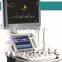 ultrasound portable machine, ultrasonido del usb digital de la computadora