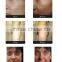 Needle free mesotherapy skin whitening face cream for men beauty instrument