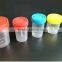 the newest products stool specimen container manufacturer