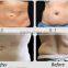 oem odm 1.3cm Focal depth hifu body shaper firm Slim for abdomen for men and woman